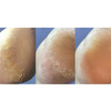 NAILSOFTHEDAY Podology+ Cream for cracked feet and hands 30 ml - Фото №4