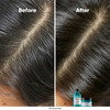 Шампунь для волос L'Oreal Scalp Advanced 300 мл - Фото №4