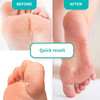 Gel for softening foot calluses Shelly Soft Blade 100 ml - Фото №4