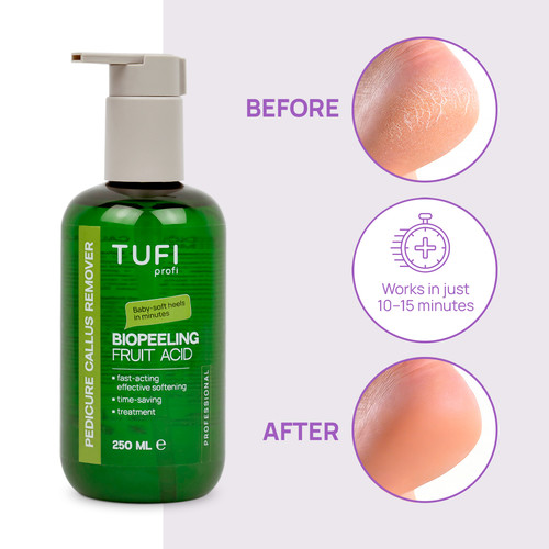 Zmywacz do pedicure TUFI profi BioPeeling Fruit Acid do zmiękczania szorstkiej skóry stóp kwaśny 250 ml (0330979) - Фото №2