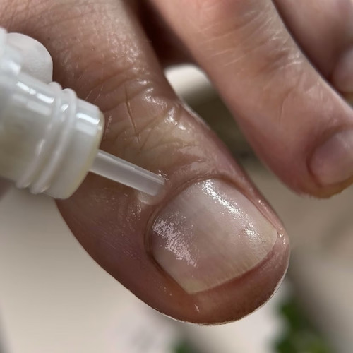 Olejek regenerujący dla paznokci z onycholizą Resultum Onistopix Oil 8 ml - Фото №3