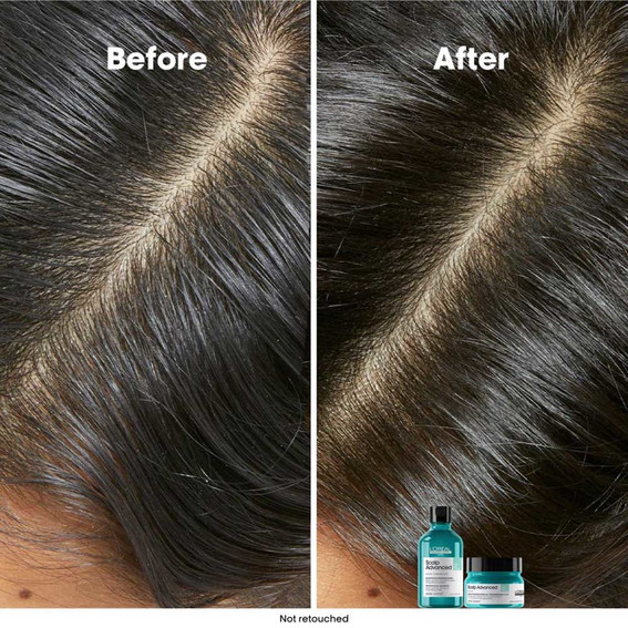 Шампунь для волос L'Oreal Scalp Advanced 300 мл - Фото №4